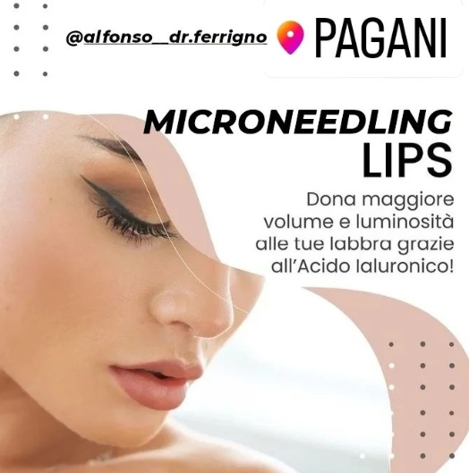 Micro Needling Lips