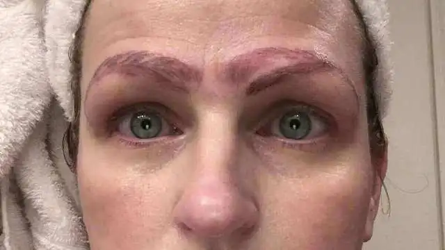 Microblading Gone Wrong: How To Avoid and Fix It