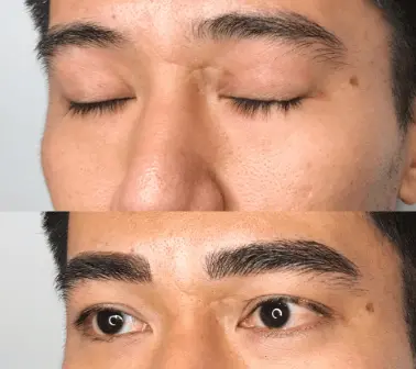 Man Microblading Ultimate Guide, Process, Result And Last