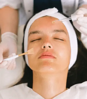 Chemical Peels for Acne Scars | The Ultimate Guide