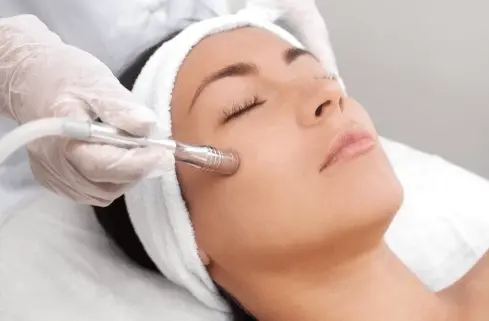 Microdermabrasion Cost