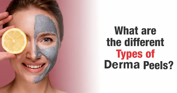 Types of Derma Peel